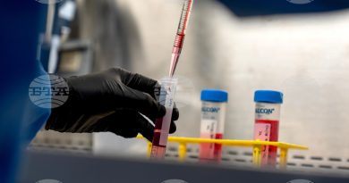 имунната система